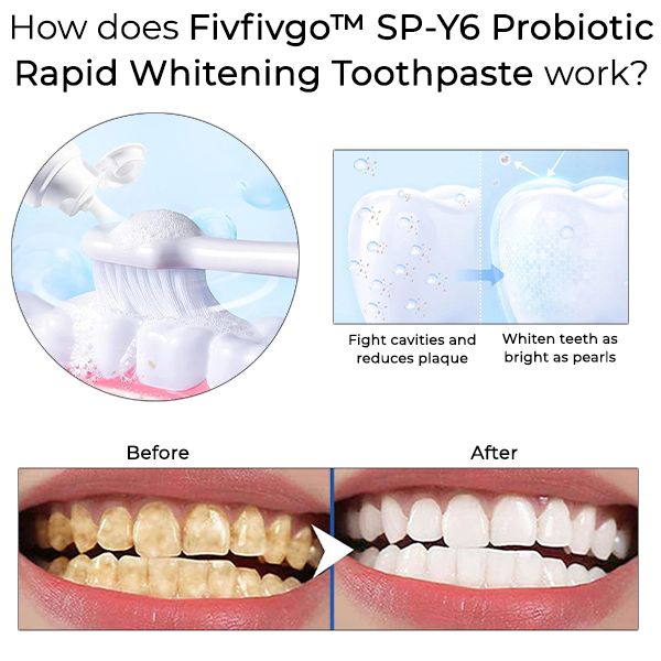 Fivfivgo™ SP-Y6 Probiotische schnell aufhellende Zahnpasta